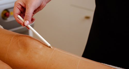 tfp-spa-laser-hair-removal